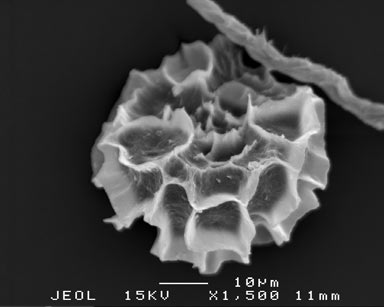 APII jpeg image of Fossombronia wattsii  © contact APII