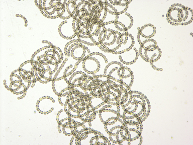 APII jpeg image of Anabaena circinalis  © contact APII