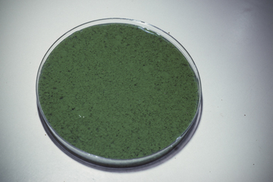 APII jpeg image of Microcystis aeruginosa  © contact APII